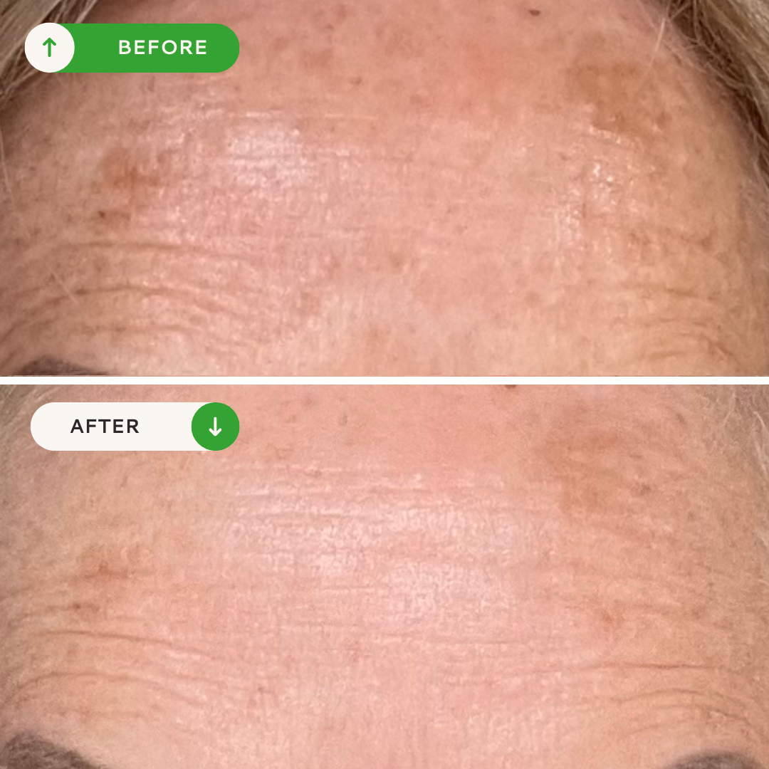 Vitamin C Glow Serum